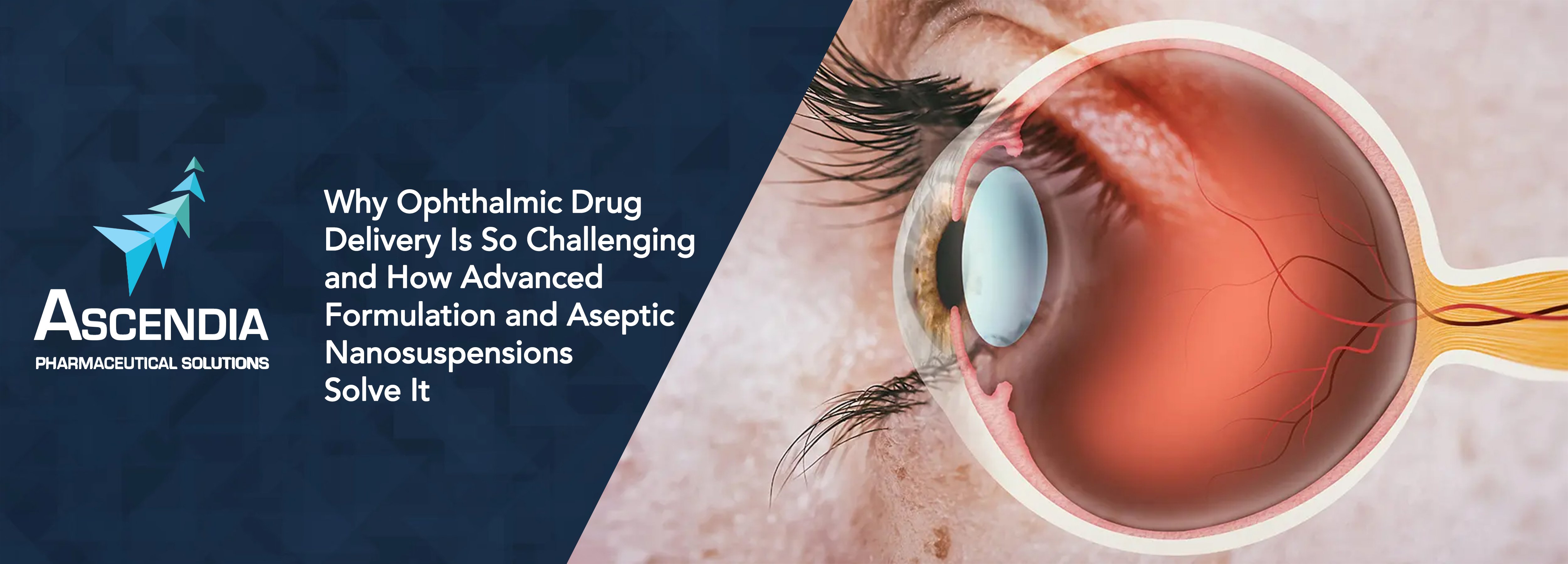 ASC-Blog_Thumb-2026-03-Why Ophthalmic Drug (1)