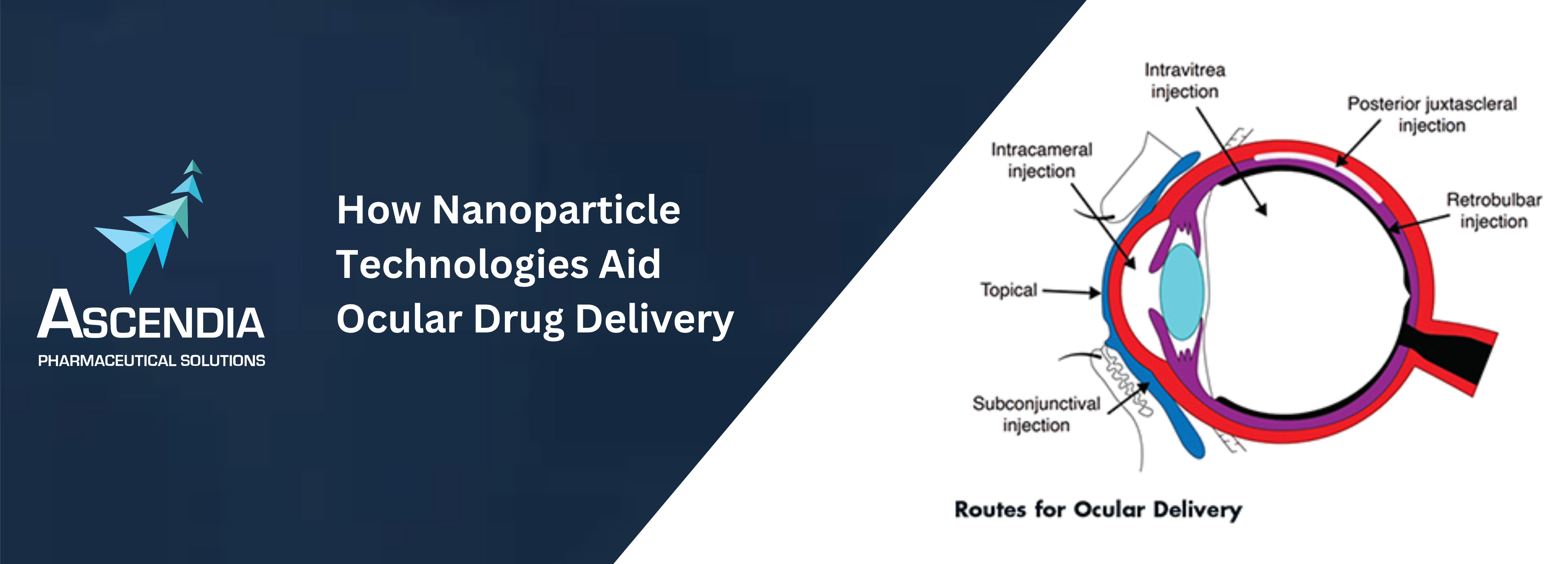 Ascendia Nanoparticle Technologies Aid Ocular Drug Delivery